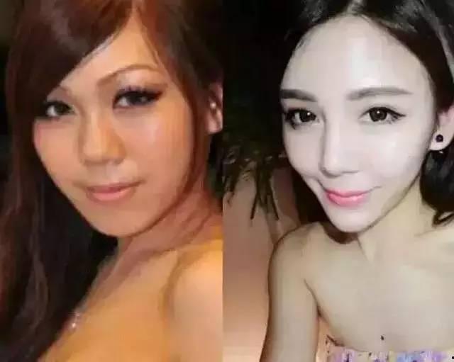 云南整形网红露露颜值,颜值巅峰的蜕变之路